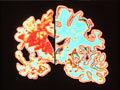Brain on left with Alzheimer's Disease - new research on causes of Alzheimer's disease
