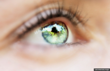 Woman's Eye, Floaters - What They Signal