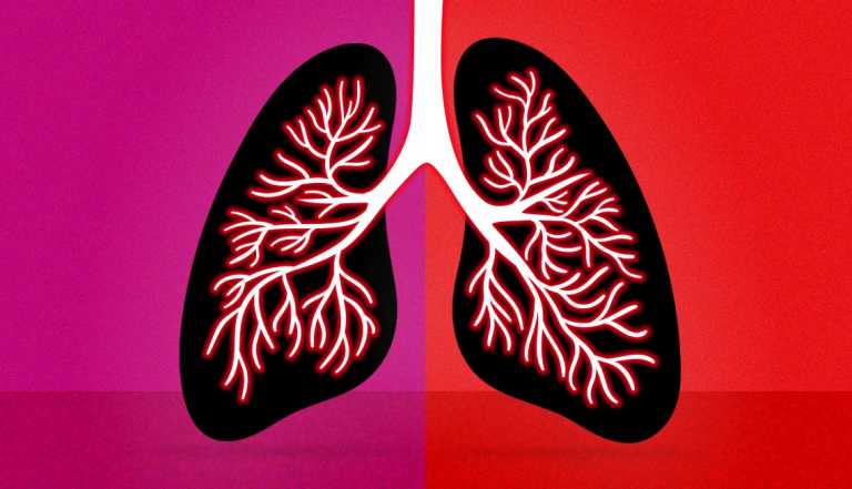 a set of lungs showing red inflamed passages the left lung is on a purple background and the right lung is on a red background