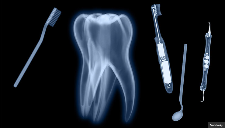x-ray of tooth and dental items