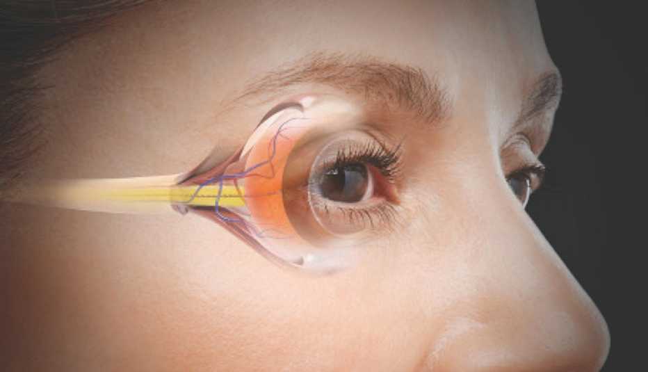 Close-up of a woman's eyes with an illustration of the eyeball.