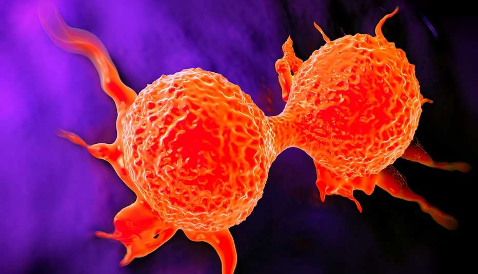 A dividing breast cancer cell showing its uneven surface and cytoplasmic projections