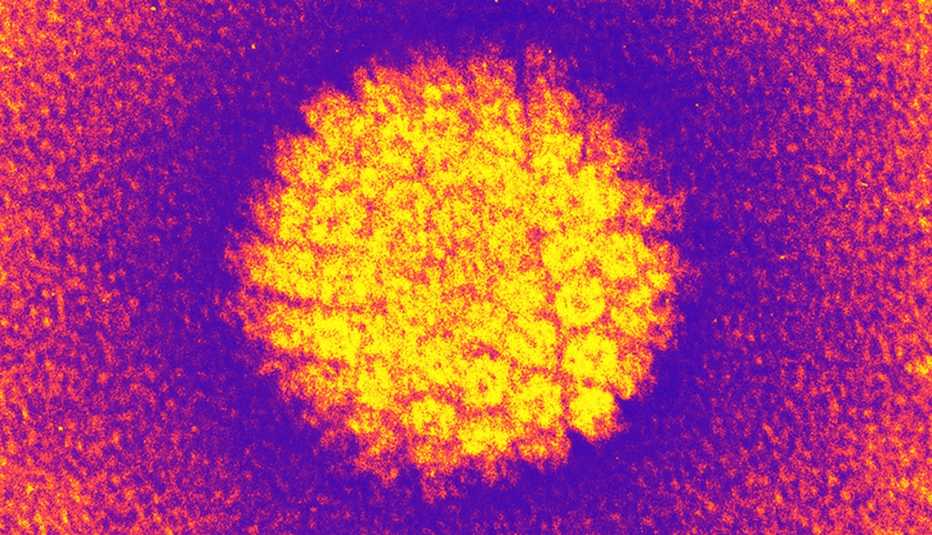 A colored transmission electron micrograph of human papilloma virus or HPV