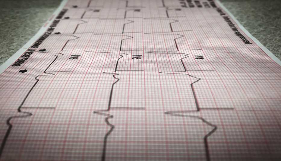 Cardiology printout