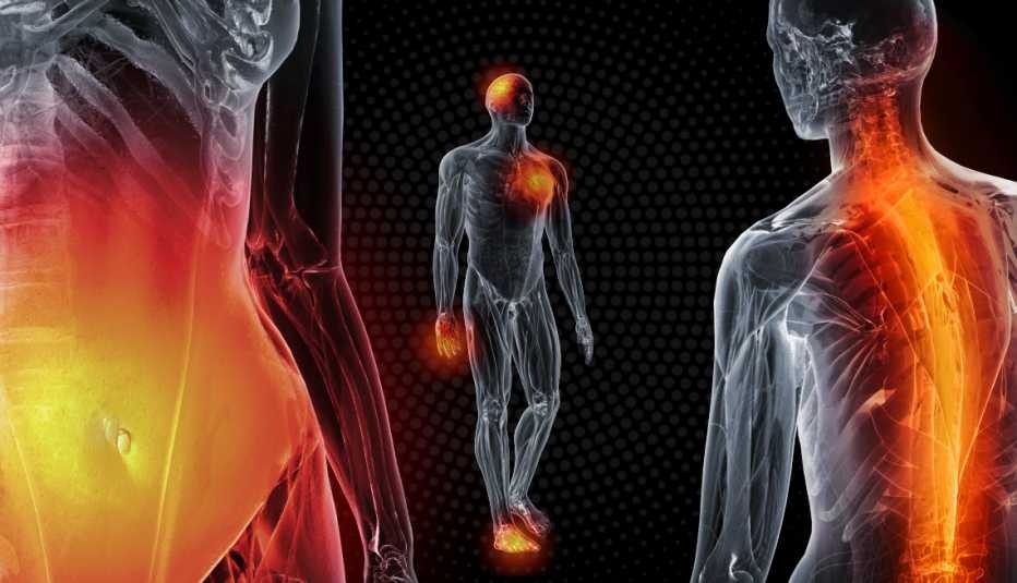images that show scientific styled see-through renderings of the human body joints and internal organs such as a stomach back and joints being irritated by inflammation