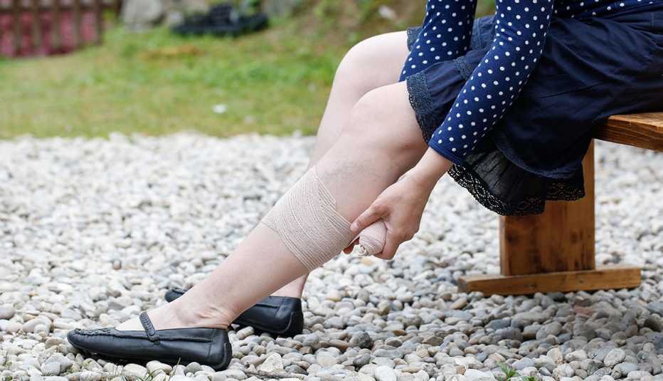 Woman with painful varicose and spider veins on her legs