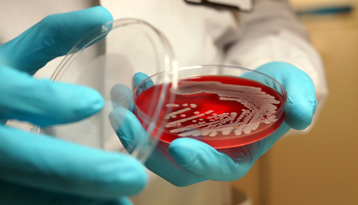 microbiologist examining growth of MRSA bacteria on a culture plate