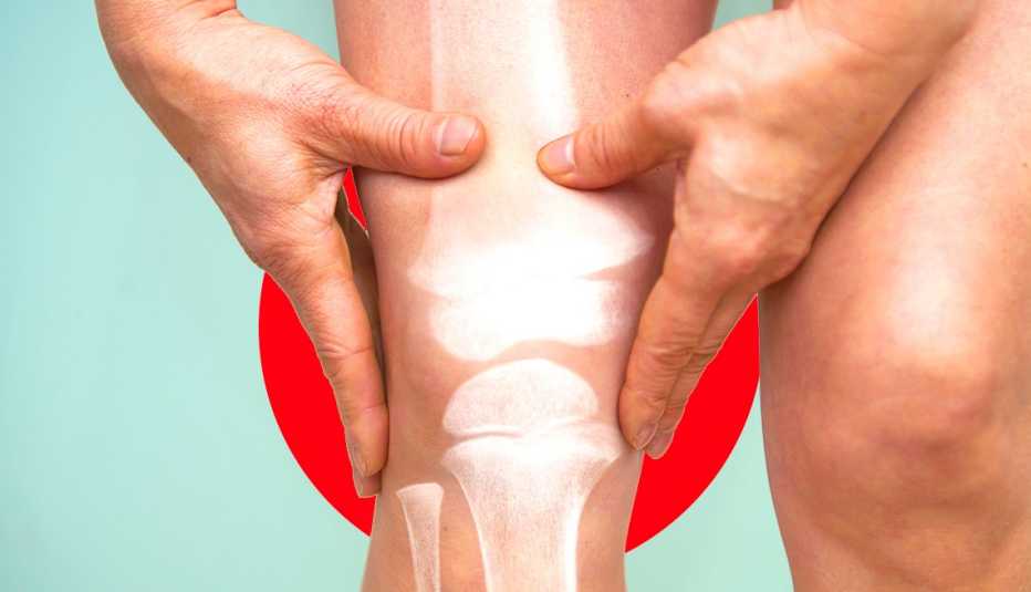 closeup of a knee join with a red circle around it indicating pain
