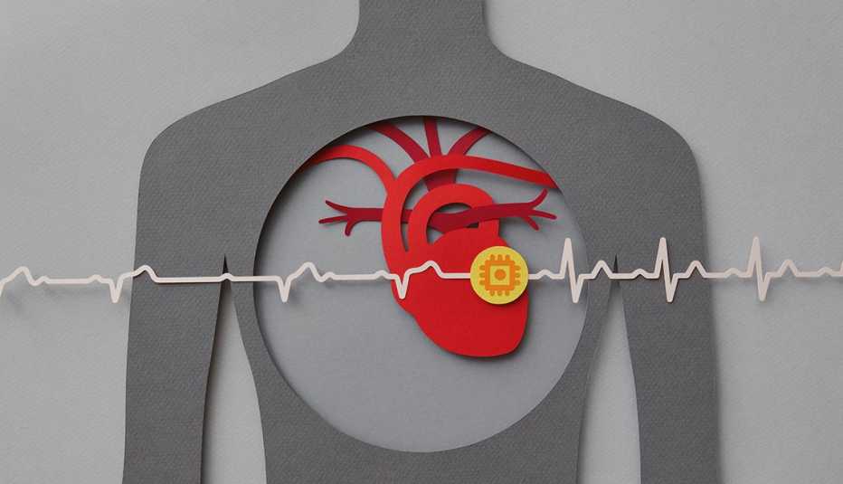 Paper craft illustration of human chest with heart and pacemaker.