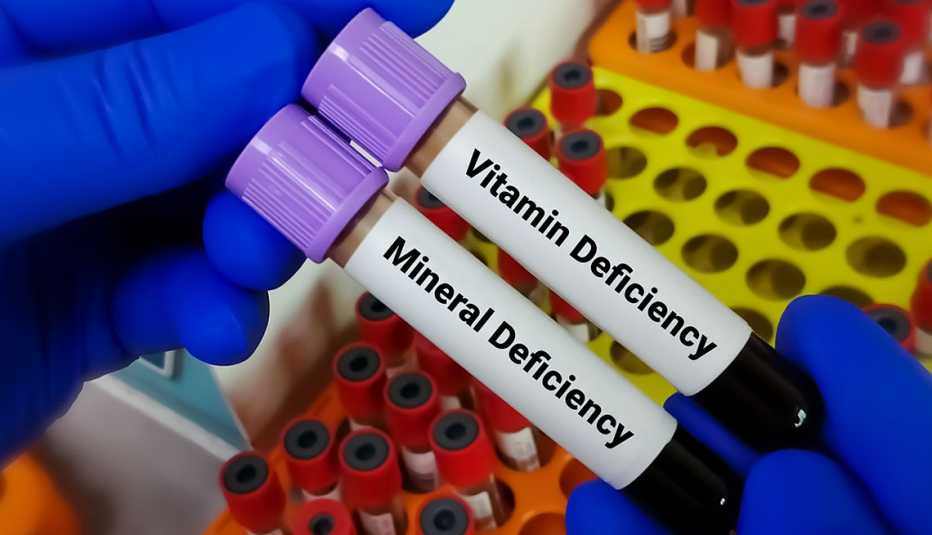 blood sample one is order for vitamin deficiency test another is mineral deficiency 