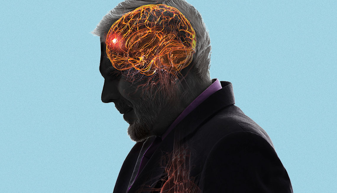 artist rendering of a mini stroke in the brain of a man