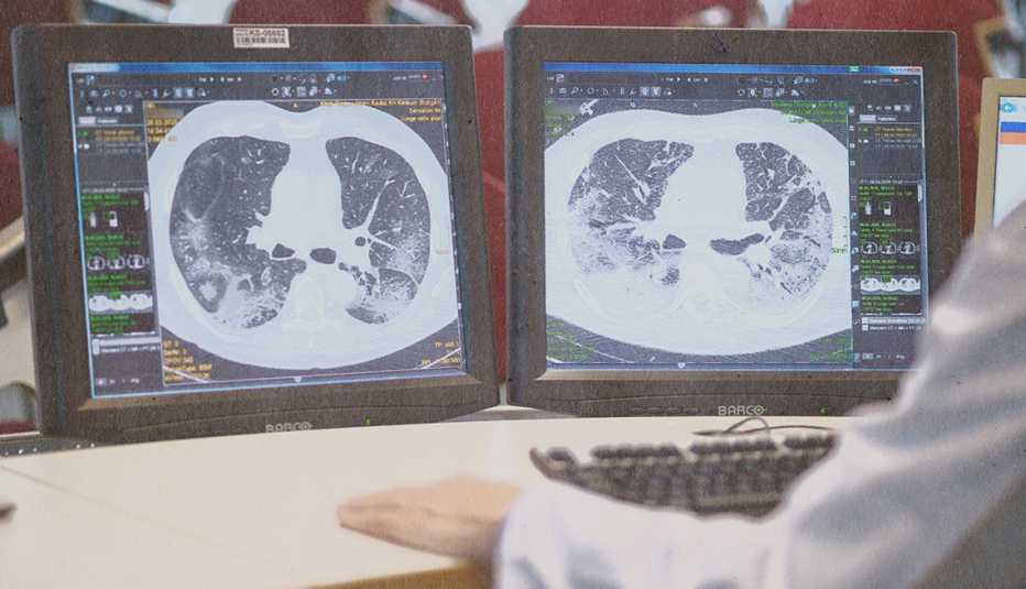 medical professional looking at monitor screens showing lung scans