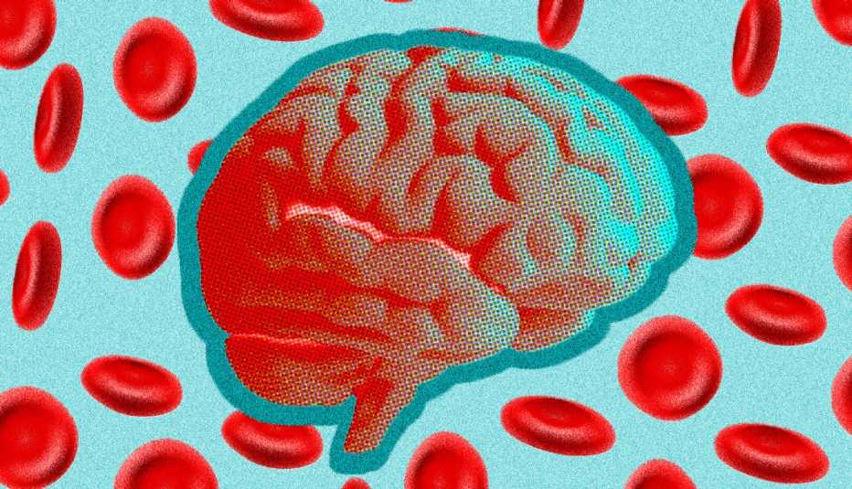 graphic of a brain surrounded by red blood cells