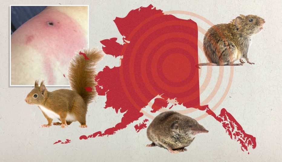 map of the state of alaska with the fairbanks area targeted and images of small mammals a red squirrel a vole and a shrew as well as a photo of an alaskapox lesion on a persons arm