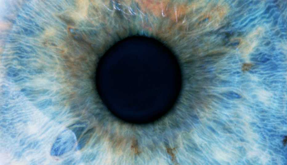 close up of a blue dilated eye during an eye exam
