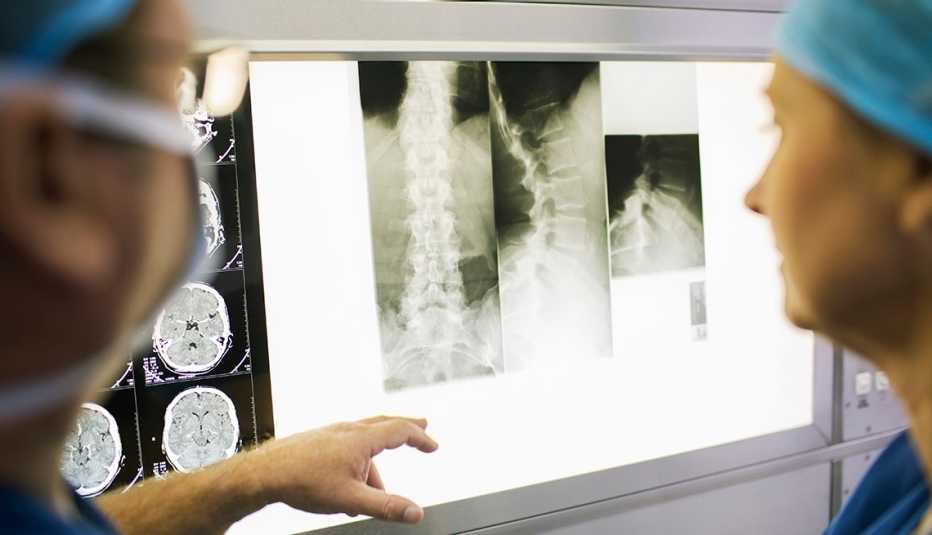 Doctors looking at spinal xray