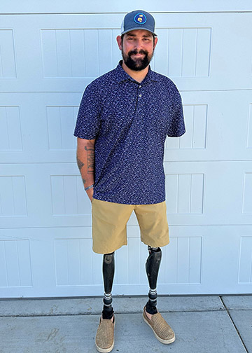 a man dressed in a blue shirt, khaki shorts and a blue baseball hat stands in front of a white background. he is a triple amputee after losing both legs and an arm