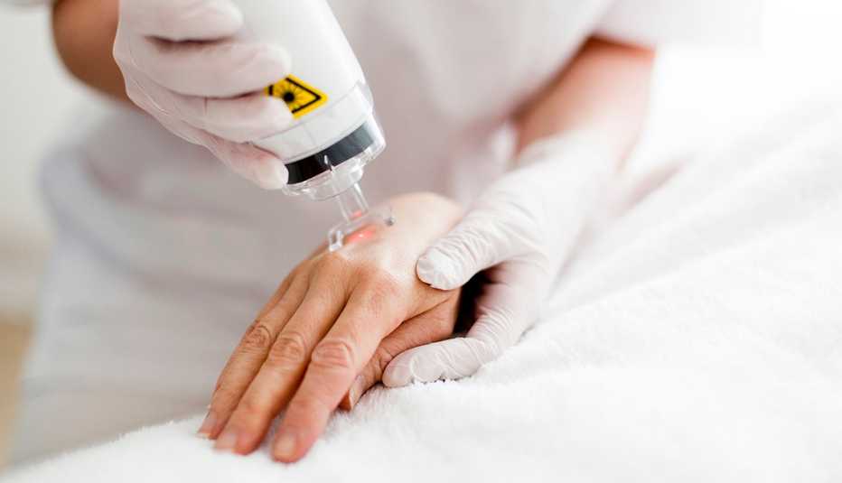 Un paciente recibe tratamiento de rejuvenecimiento cutáneo con láser en su mano.