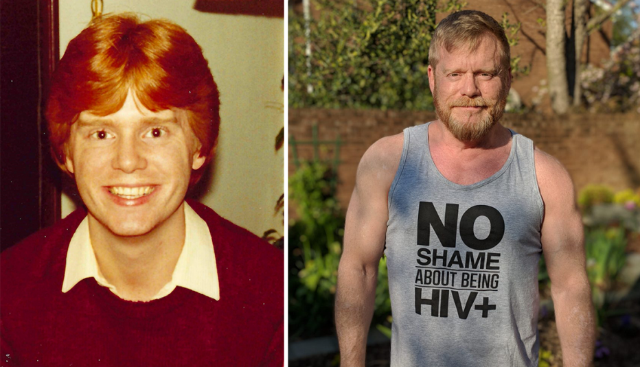 Dos imágenes de Mark King, antes y después del diagnóstico positivo de VIH