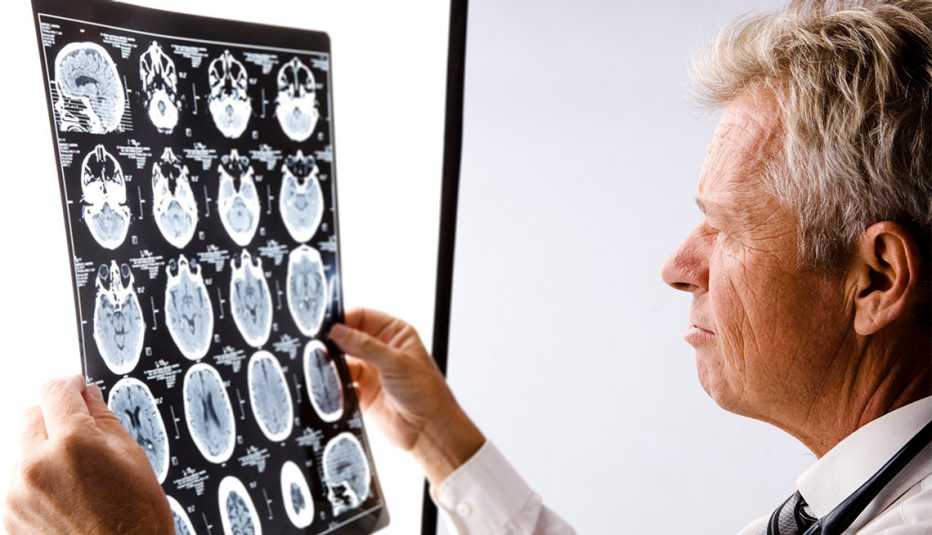 Médico observa una radiografía del cerebro