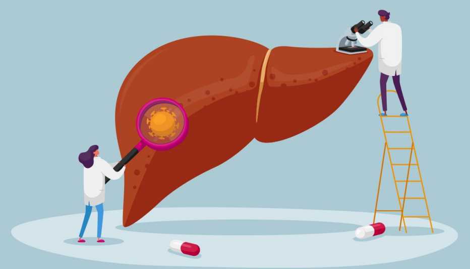 Ilustración de dos médicos examinando un hígado humano gigante y en el suelo dos pastillas