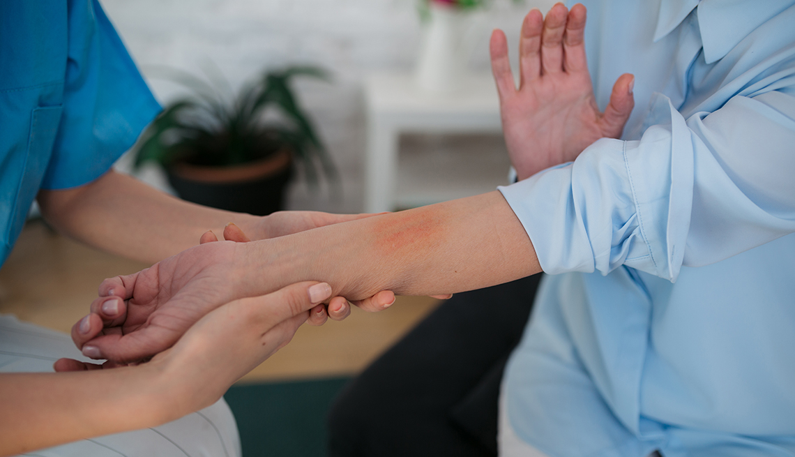 Un profesional médico examina un sarpullido en el brazo de un paciente