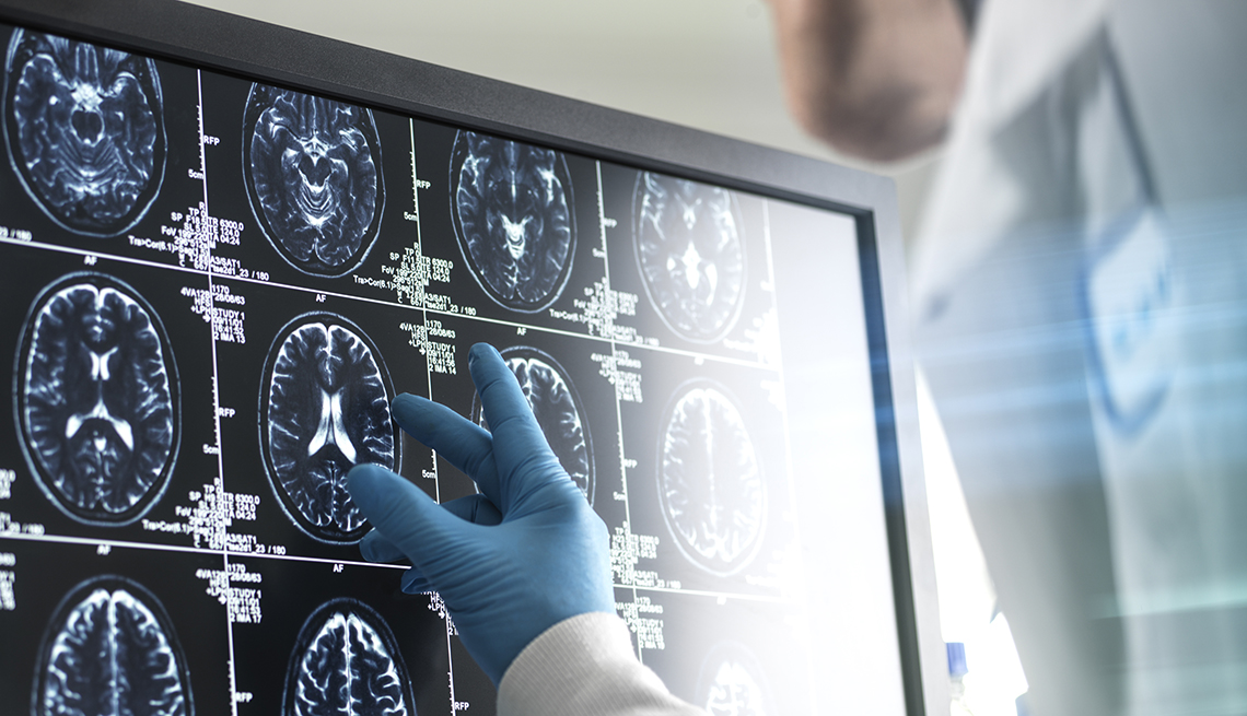 Un médico analiza una radiografía del cerebro de una persona