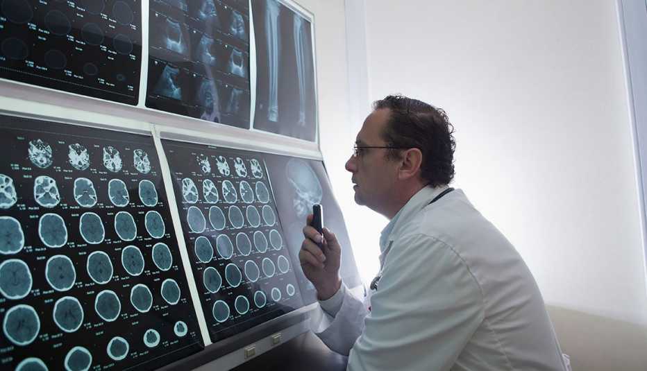 Un médico examina las radiografías cerebrales de un paciente