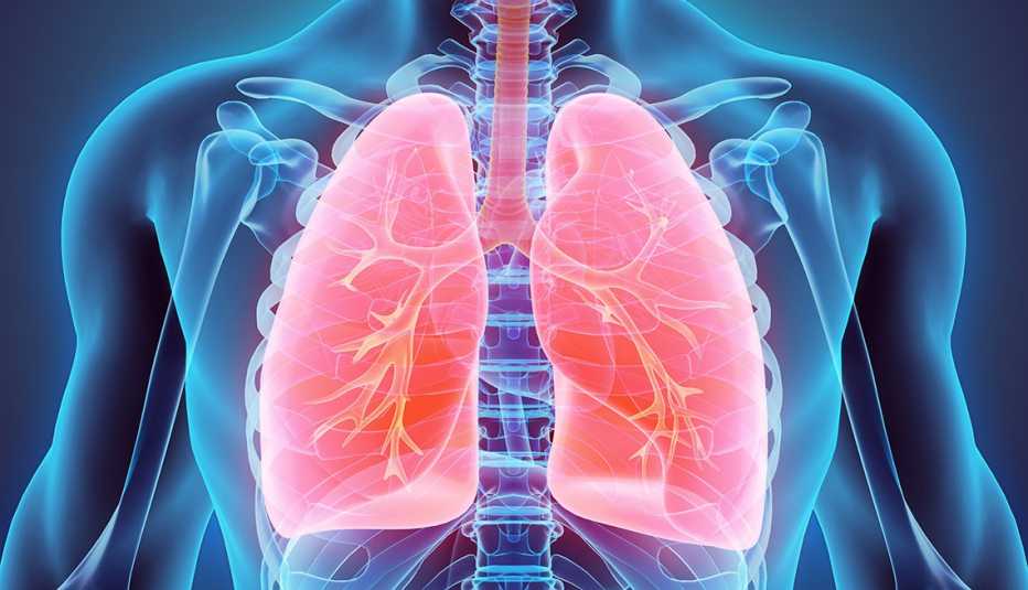 Ilustración de una persona donde se destacan los pulmones
