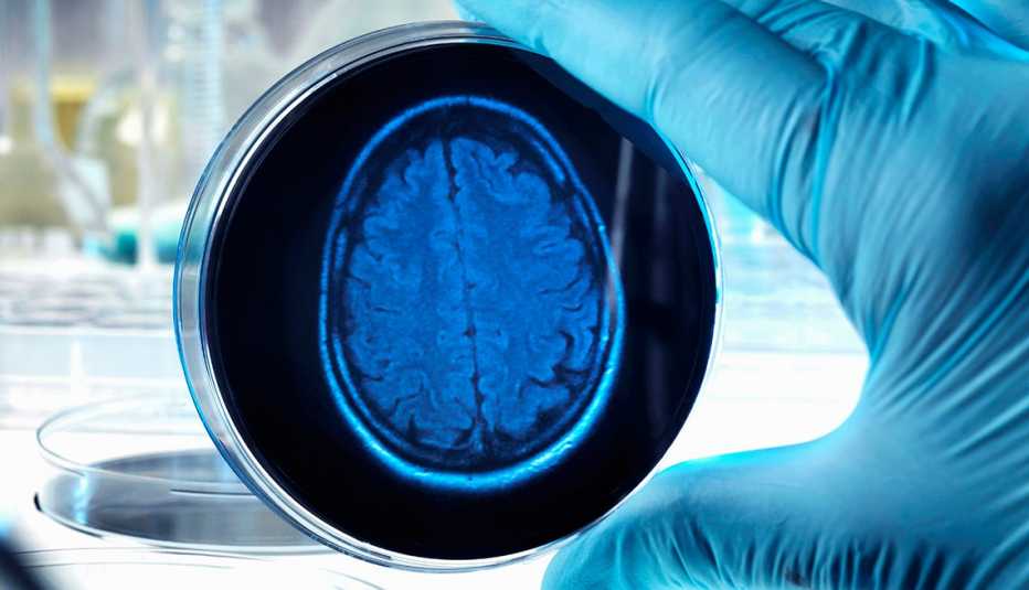 Científico con una placa de petri con la imagen de un cerebro