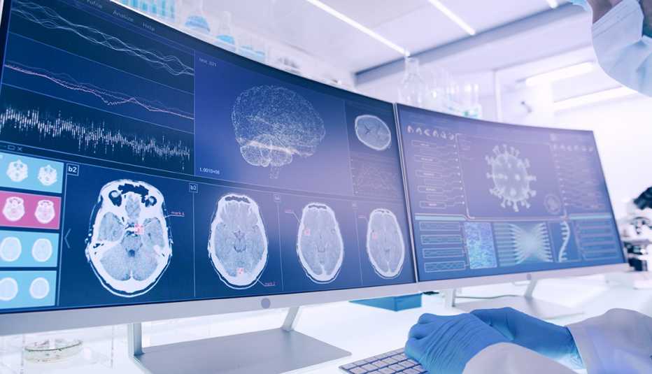 Profesional de la salud mira a varios monitores con imágenes computadorizadas del cerebro