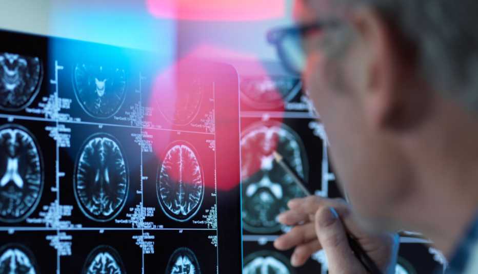 Un doctor mira una radiografía del cerebro