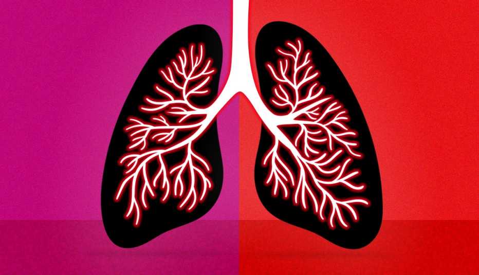 Ilustración de unos pulmones inflamados