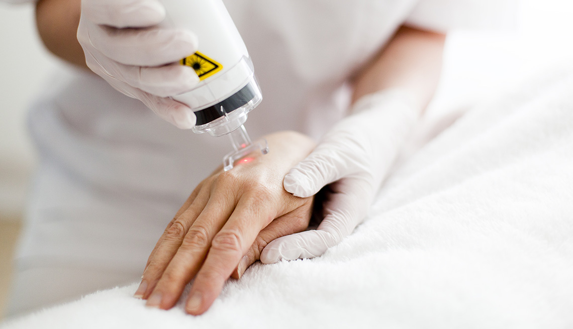 item 10 of Gallery image - Un paciente recibe tratamiento de rejuvenecimiento cutáneo con láser en su mano.