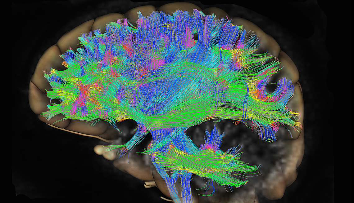 Scan of neurons in brain