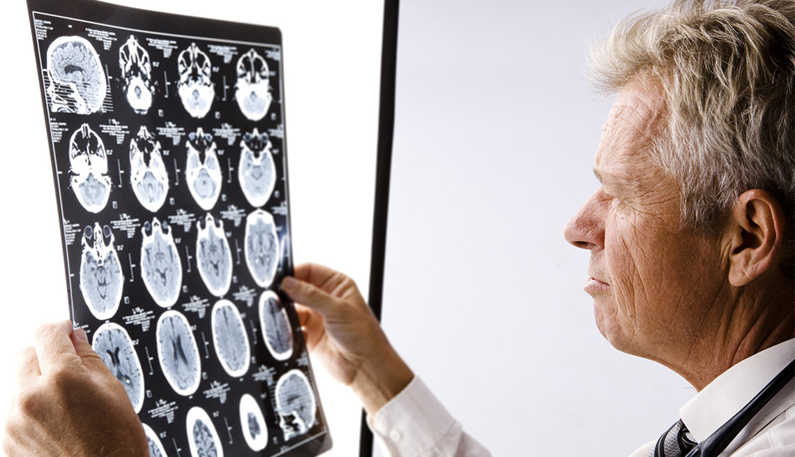 Médico observa una radiografía del cerebro