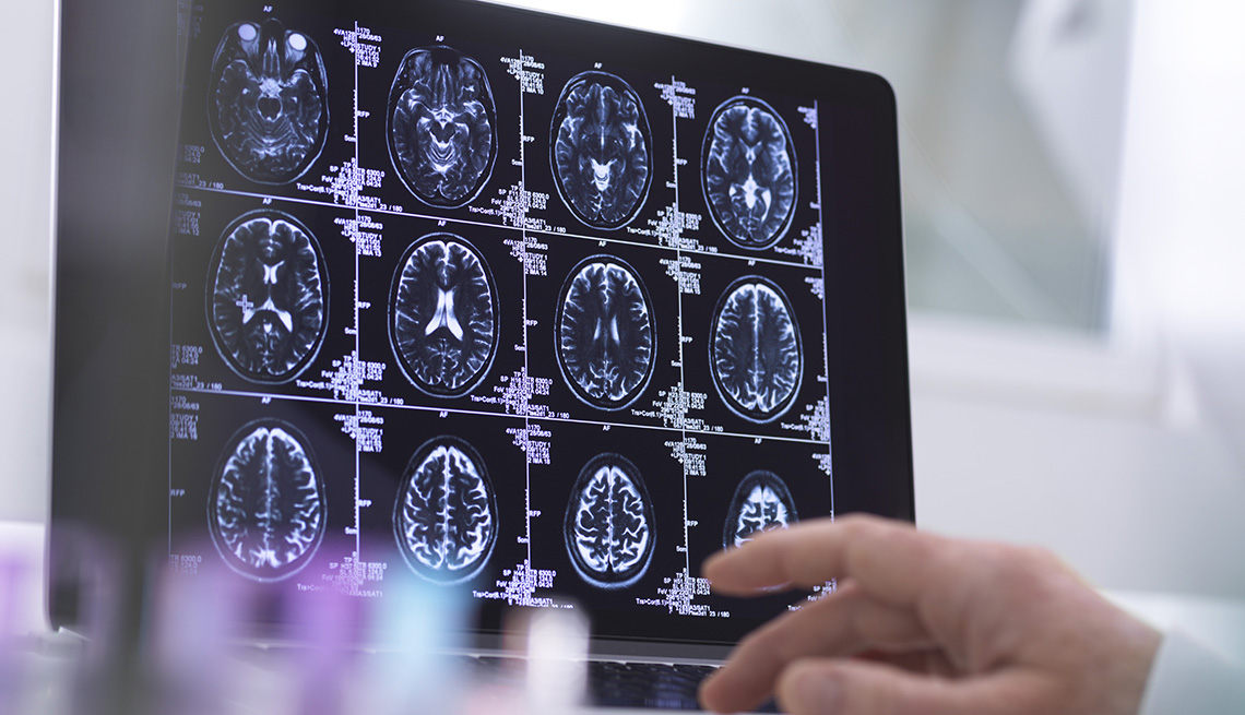 Radiografía de un cerebro humano siendo analizado