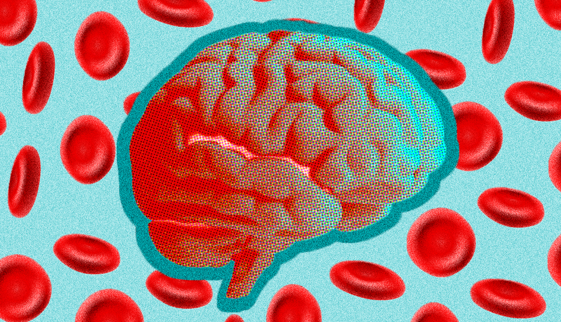 Ilustración de un cerebro rodeado de glóbulos rojos