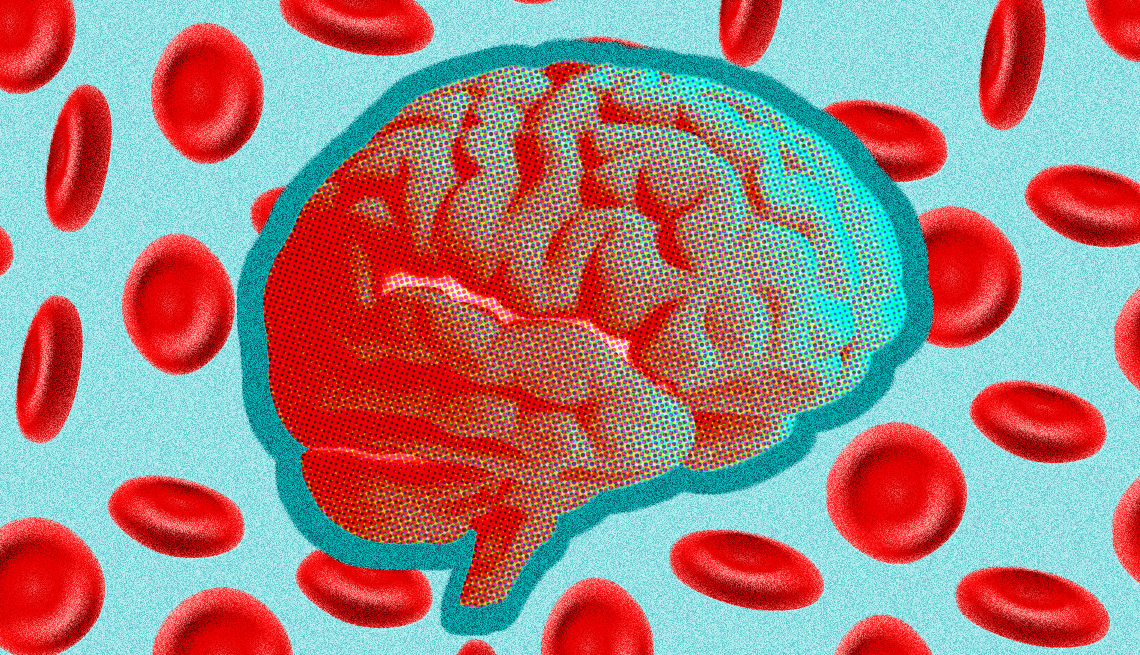 Is There a Blood Test for Alzheimer's and Dementia? - Vimarsana News