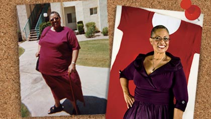 Bariatric surgery to lose weight. Before and after pictures of Joyce Lewis.