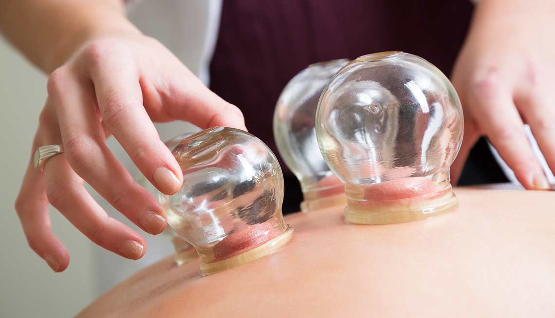 Ways To Ease Shingles Pain Cupping