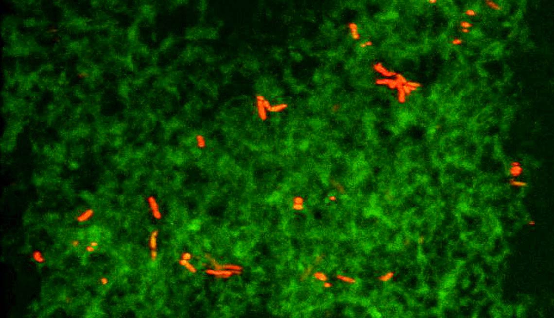 Salmonella Bacteria and protein calledbeta, Alzheimer's Research