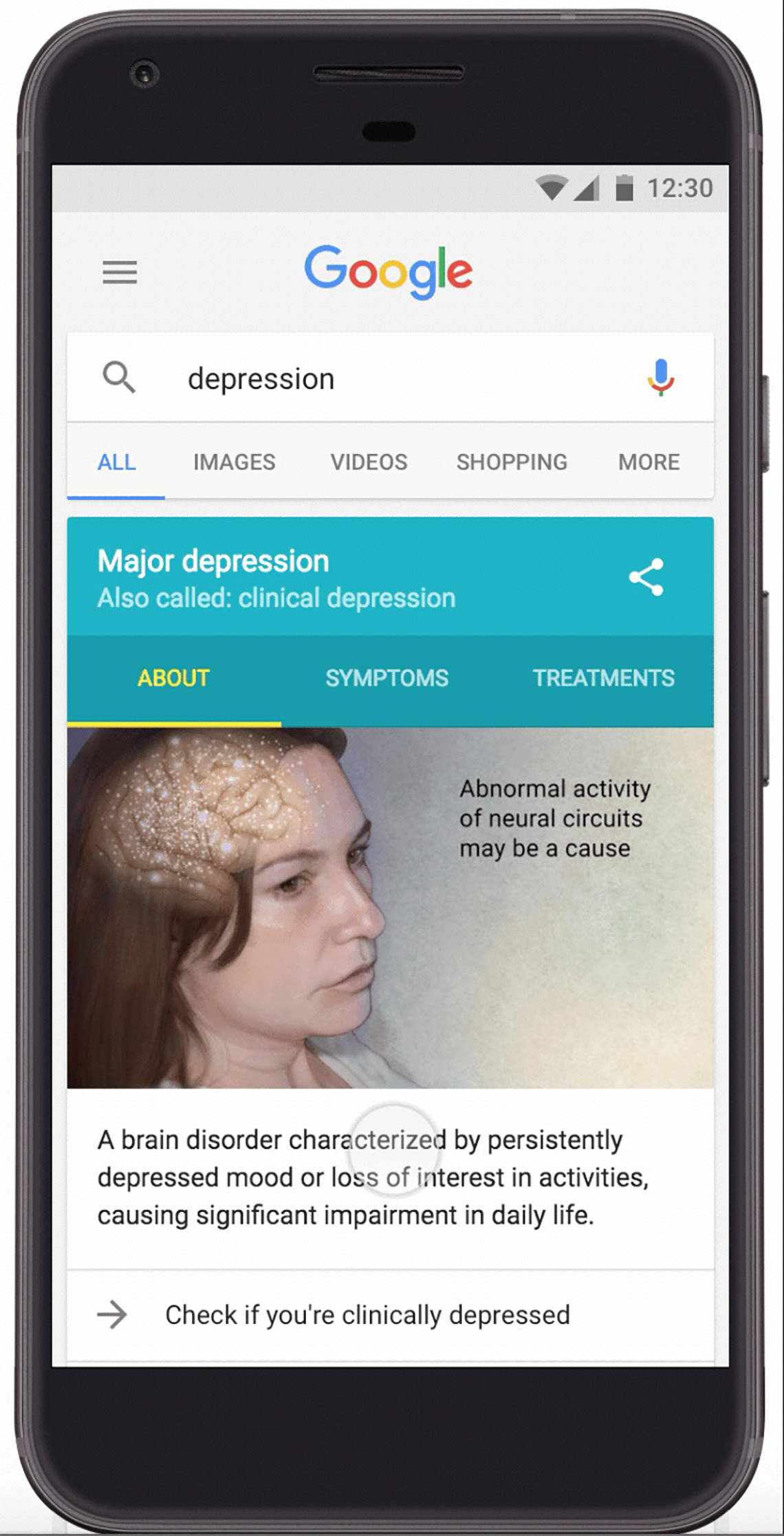 Should you test your mental health on Google
