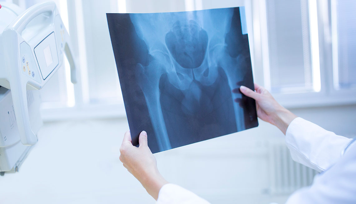 Médico viendo una radiografía de las caderas