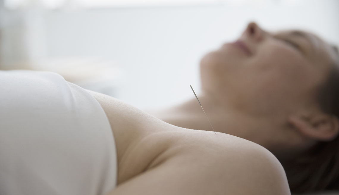 Mujer siendo tratada con acupuntura