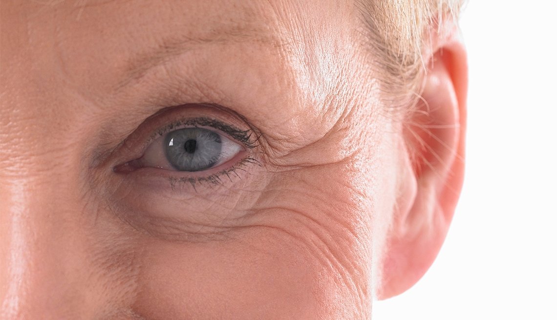 Understanding Belpharoplasty, Eyelid Plastic Surgery
