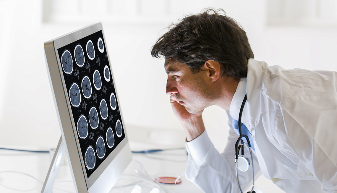 Un doctor mira la radiografía de un cerebro en una pantalla