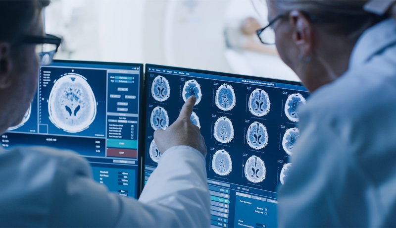 Doctors confer as they point to a brain scan on a computer screen