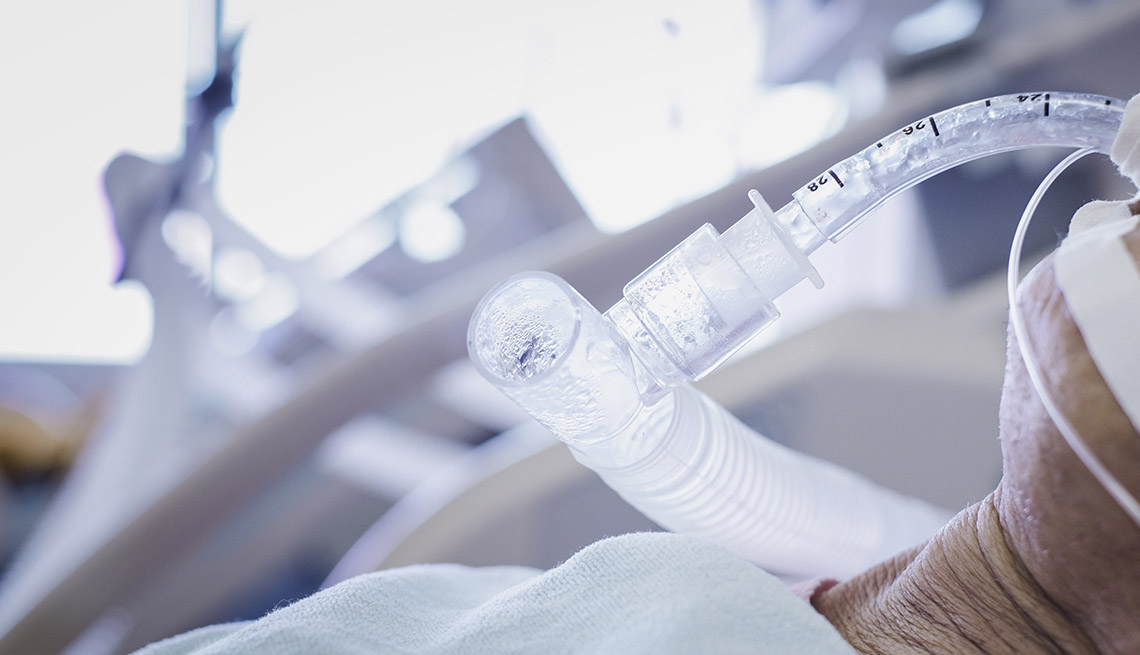 close up of endotrachel tube giving oxygen to hopsitalized patient 