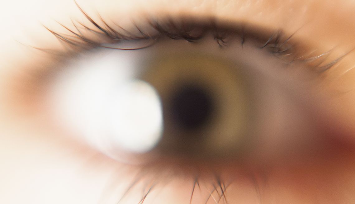 Colirios para los ojos rojos - Asociación Mácula Retina